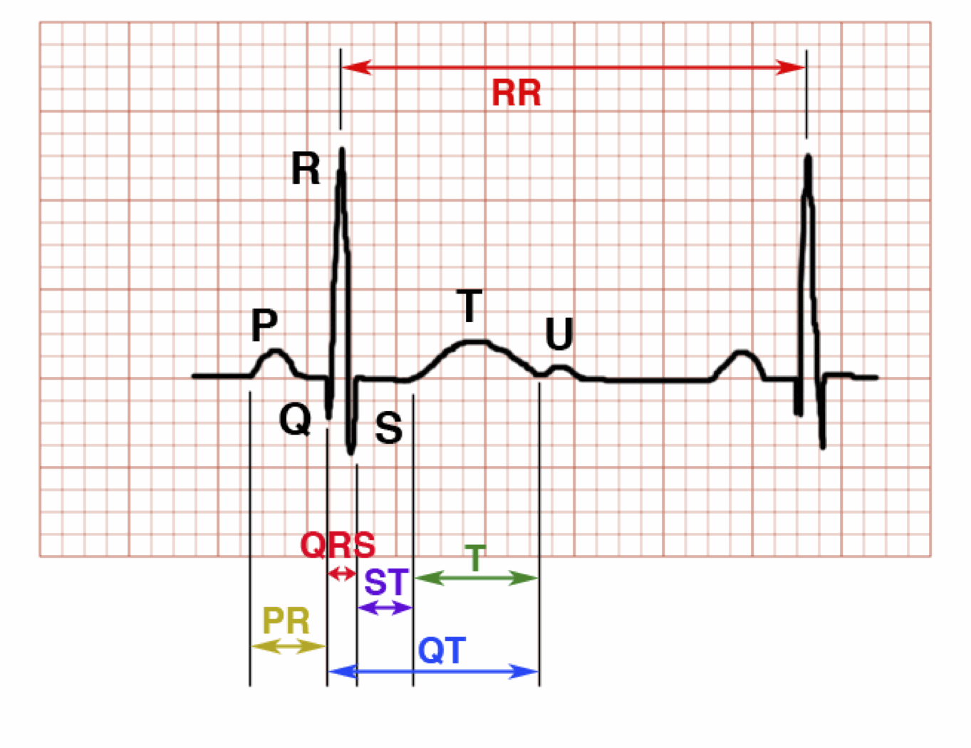 ECG calculations